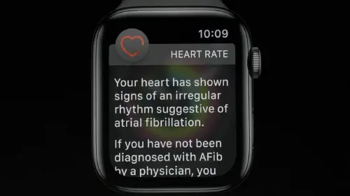 assets/44114-85753-210830-AppleWatch-xl.jpeg