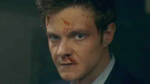 assets/jack-quaid-s-bloody-and-bruised-face-in-the-2025-movie-novocaine.jpeg