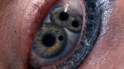 assets/an-eye-with-three-pupils-in-the-substance.jpeg