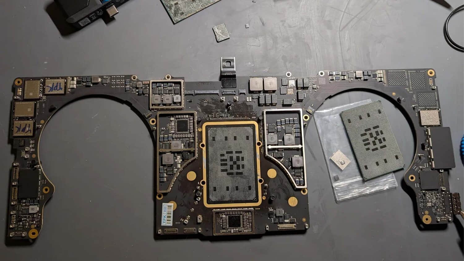 M1-Max-transplant-performed-1.jpeg