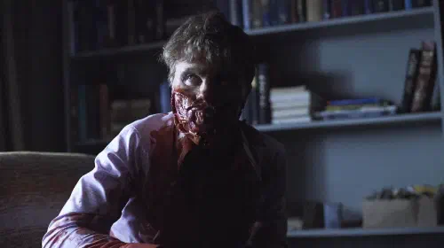 assets/mason-verger-with-a-cut-up-face-in-hannibal-season-2.jpeg