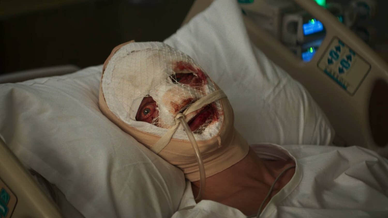 matt-hagen-bandaged-in-bed-in-clayface-trailer.jpeg